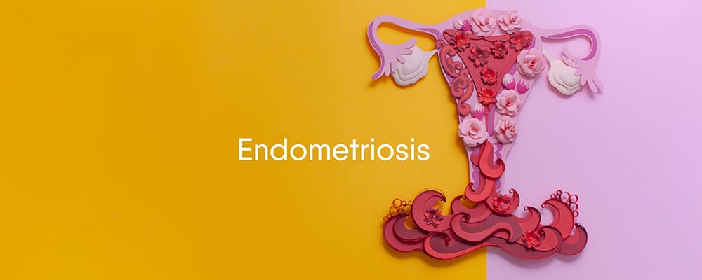 Endometriosis