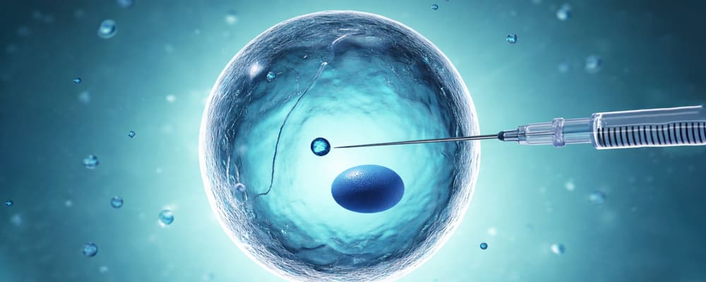 Ovulation Induction